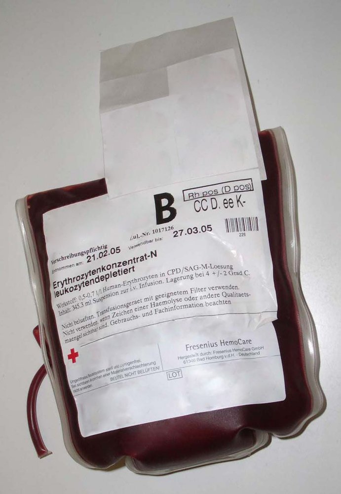 Jehovahs Witnesses blood transfusion policy